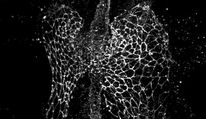 RCGZO1-16s18s_10_Series035W_002_ZO1onlyscale