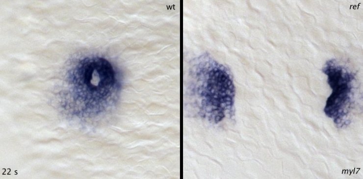 wt_ref_22s_myl7-1